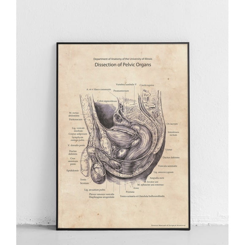 Plakat anatomiczny „Dysekcja narządów miednicy”