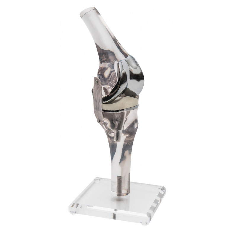 Erler-Zimmer model kolana z endoprotezą 4449