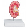 Kamienie nerkowe model anatomiczny - naturalny rozmiar - Erler Zimmer